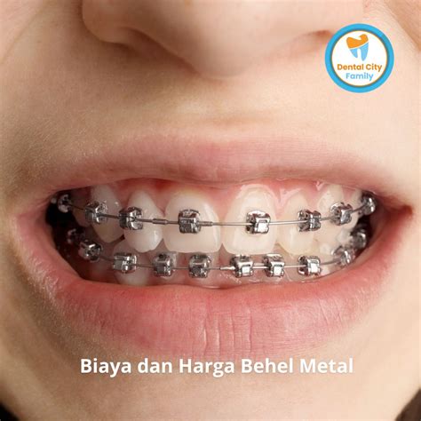 harga behel metal